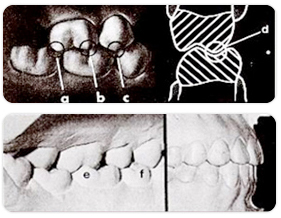 정상적인 치아상태 정상교합 설명사진1
